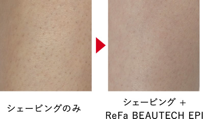 エクルベージュ ReFa 脱毛器 - crumiller.com