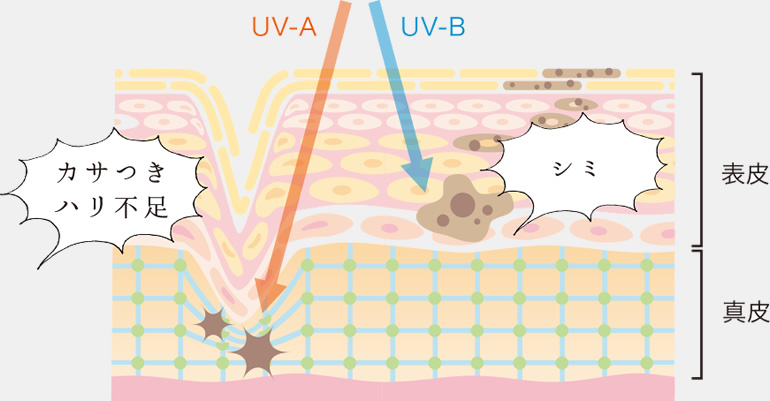 UV-A、UV-Bによる肌ダメージ